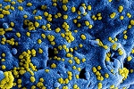 coronavirus 150x100 1